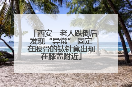 西安一老人跌倒后发现“异常” 固定在股骨的钛针竟出现在膝盖附近